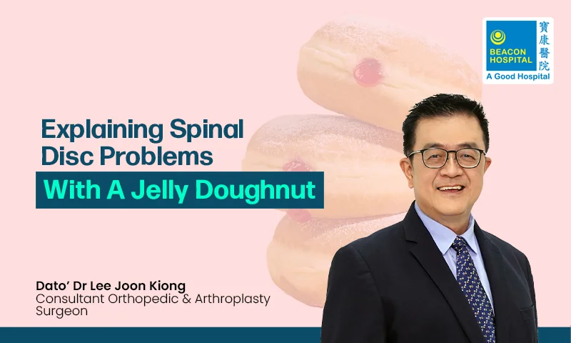 Explaining Spinal Disc Problems With a Jelly Donut