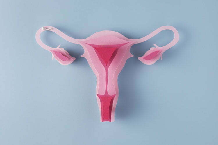 Ovarian Cancer