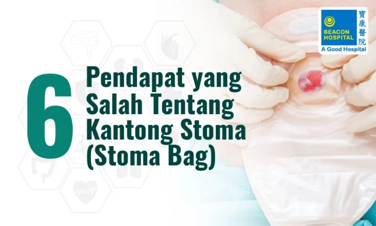 Enam pendapat yang salah tentang Kantong Stoma (Stoma Bag)