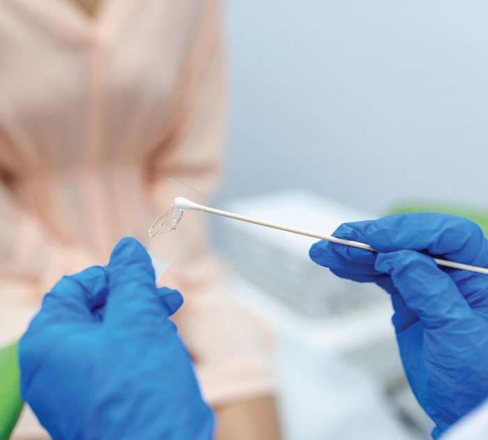 Pap-Smear-Screening-Service-Beacon-Hospital-Malaysia