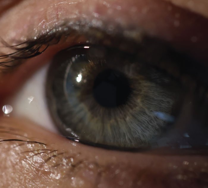 Retinal-Eye-Screening-Procedure
