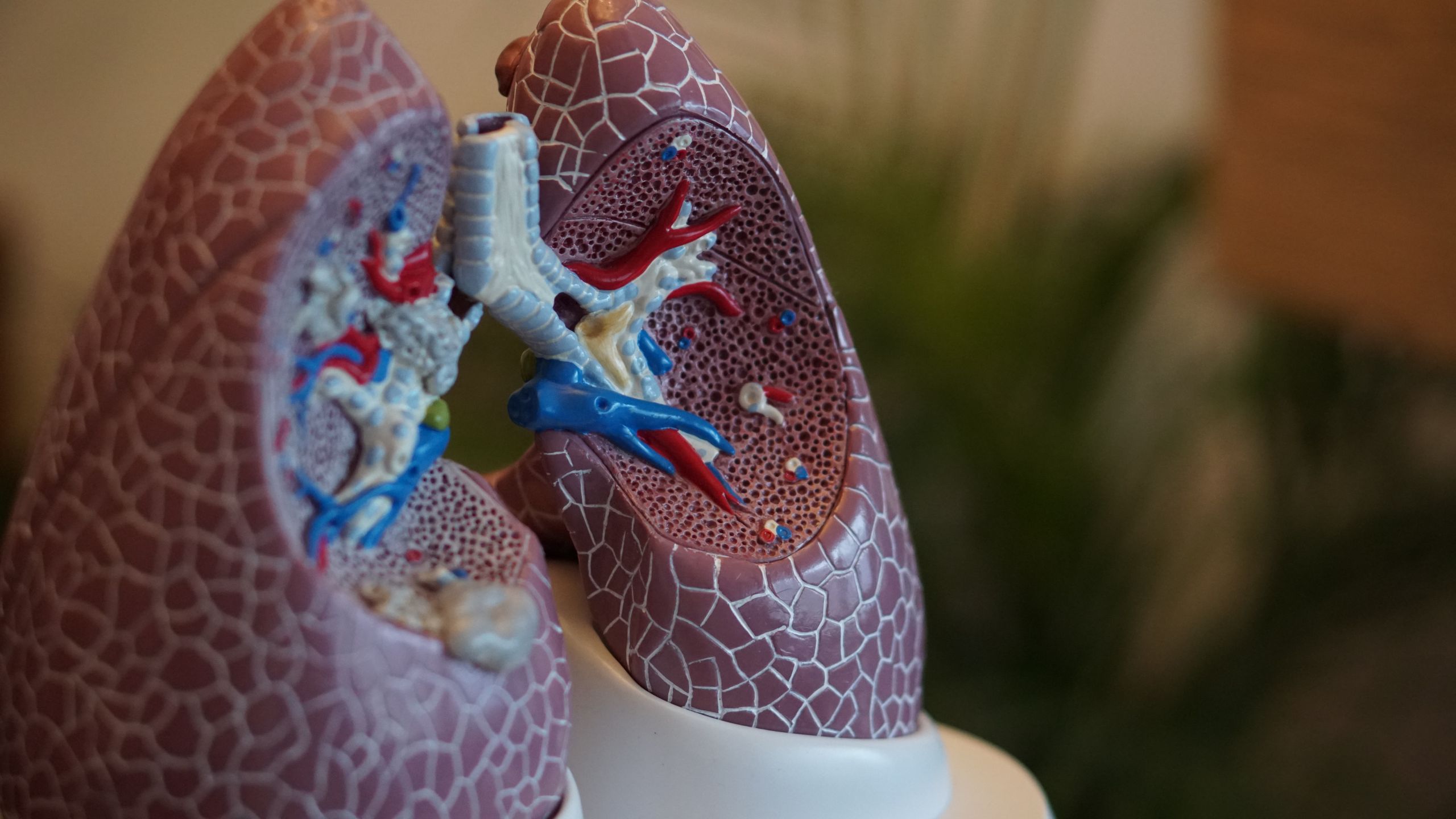 What’s-my-risk-for-lung-cancer-blog-beacon-hospital-malaysia