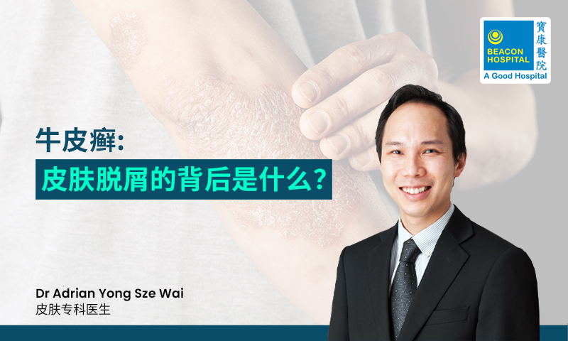牛皮癣: 皮肤脱屑的背后是什么？