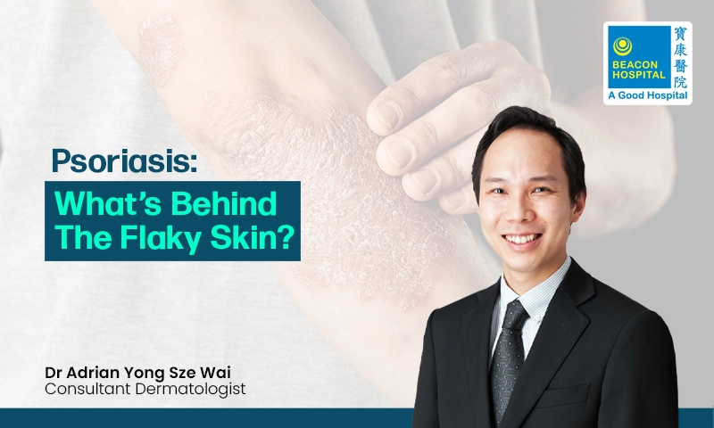 Psoriasis : What’s Behind the Flaky Skin?
