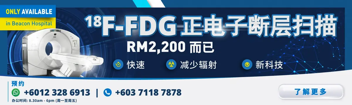18F-FDG PET-CT SCAN With DISCOVERY