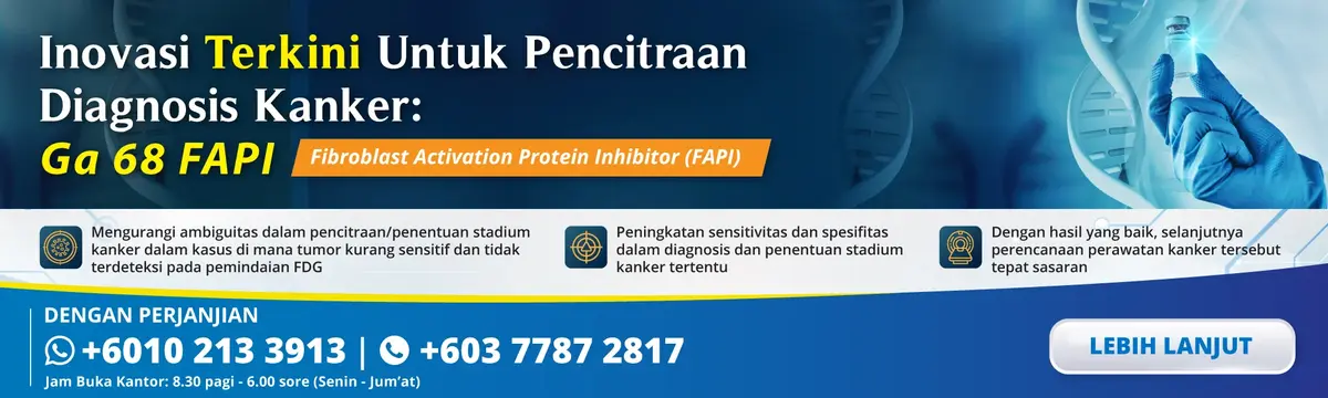 Ga-68 FAPI PET-CT