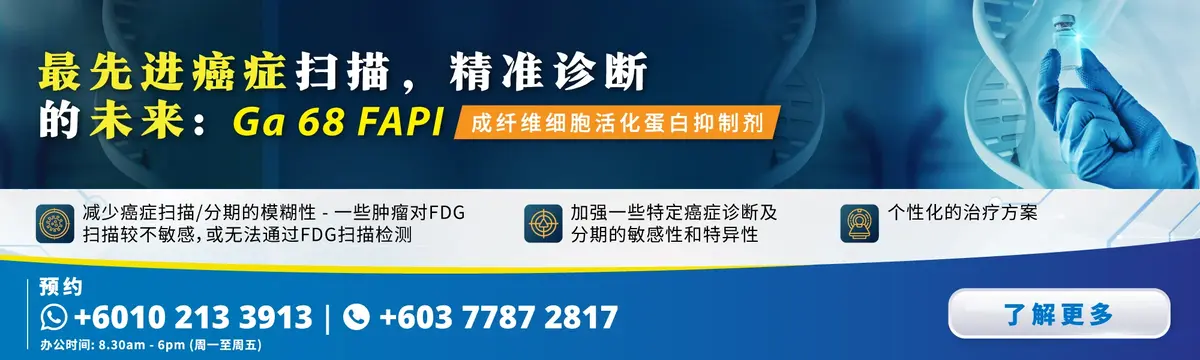 Ga-68 FAPI PET-CT