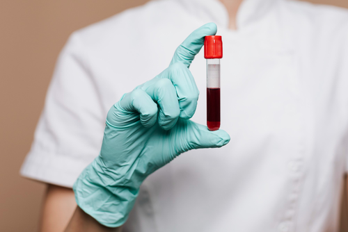 haematology