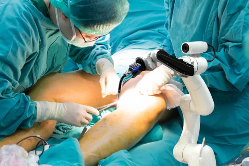 knee surgery