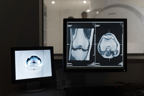 nuclear medicine