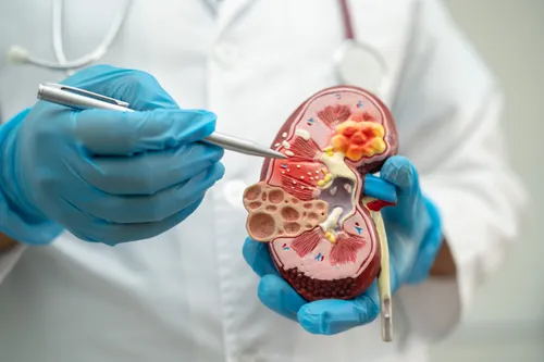 doctor holding a kidney model