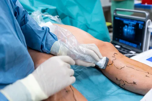 leg marking