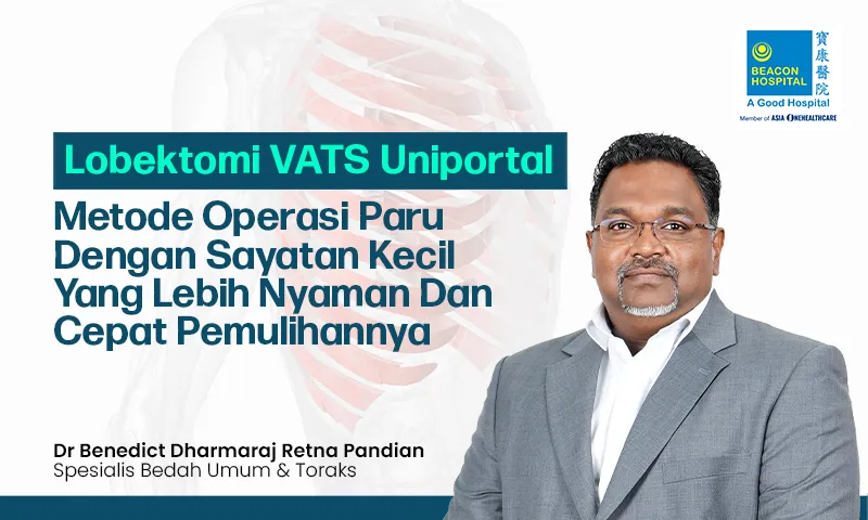 Lobektomi VATS Uniportal: Metode Operasi Paru dengan Sayatan Kecil yang Lebih Nyaman dan Cepat Pemulihannya.